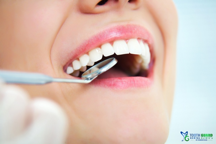 Gum abscess treatment
&nbsp;